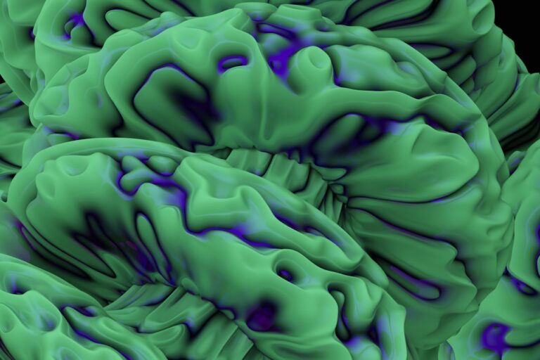 Photo Bipolar disorder: Brain scan