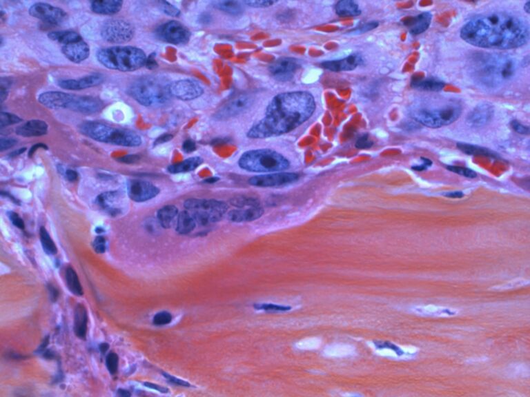 Photo Thyroid gland