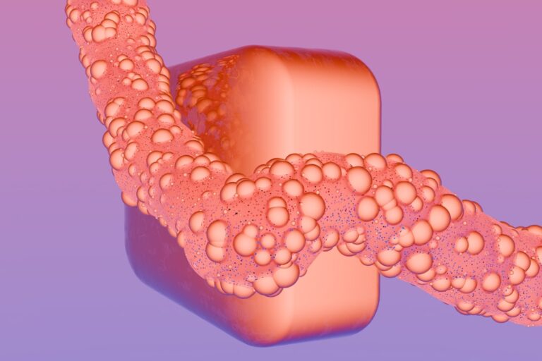 Photo Sindromul Colonului Iritabil